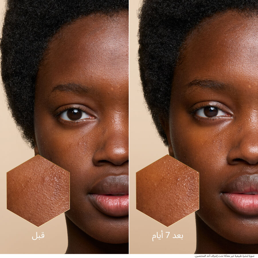 يووث واتوري أويل سيروم (انظر الصورة 6/6)